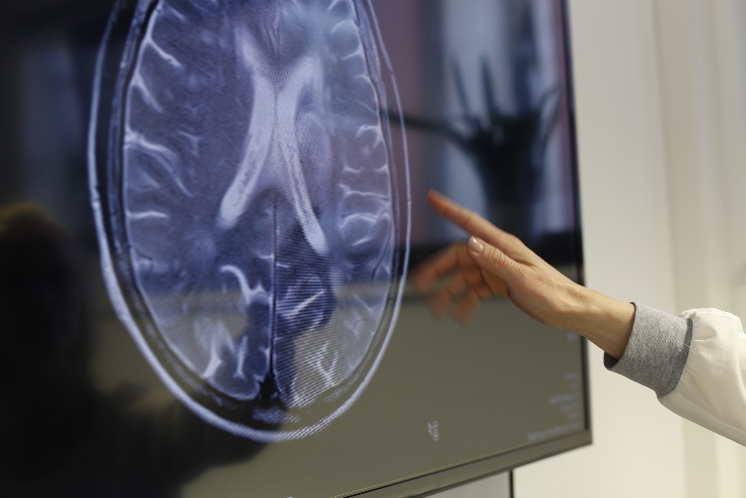 Minimalinvasive bildgestützte Eingriffe - Interventionelle Radiologie