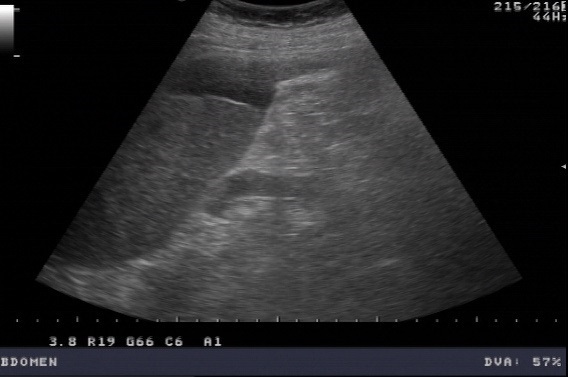 Ultraschalldiagnostik MSK