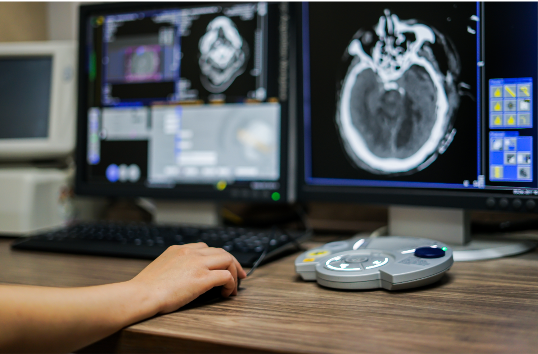 CT Cardio CT